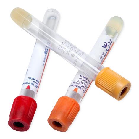 Vacutainer Venous Blood Collection Tube without Additives, Glass, Red Closure, Paper Label, 16 x 100 mm, 10 mL