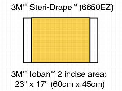 3M Ioban 2 Antimicrobial Incise Drape, 23